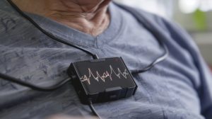 Portable ECG Device