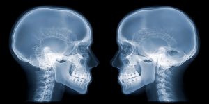 XRay